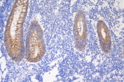 IHC staining of FFPE human appendicitis tissue with Desmoglein 2 antibody. HIER: boil tissue sections in pH8 EDTA for 20 min and allow to cool before testing.