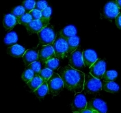 Immunofluorescent staining of FFPE human MCF7 cells with Desmoglein 2 antibody (green) and DAPI nuclear stain (blue). HIER: steam section in pH6 citrate buffer for 20 min.