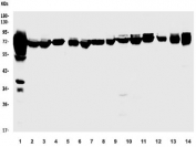 Western blot testing of human 1) HepG2, 2) Raji, 3) T-47D, 4) U-2 OS, 5) A431, 6) K562, 7) PC-2 and 8) rat brain, 9) rat spleen, 10) rat kidney, 11) rat liver, 12) mouse brain, 13) mouse kidney and 14) mouse Neuro-2a lysate with PCK2 antibody. Predicted molecular weight ~71 kDa.