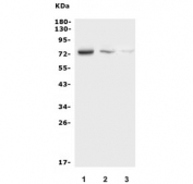 Western blot testing of 1) human K562, 2) rat spleen and 3) mouse spleen lysate with NDC80 antibody. Expected molecular weight: 74-80 kDa.