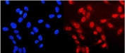 Immunofluorescent staining of FFPE human U-2 OS cells with Neurofibromin antibody (red) and DAPI nuclear stain (blue). HIER: steam section in pH6 citrate buffer for 20 min.
