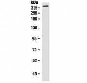 Western blot testing of human HeLa cell lysate with Neurofibromin antibody. Predicted molecular weight ~319 kDa.