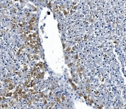 IHC staining of FFPE rat liver with IRAK2 antibody. HIER: boil tissue sections in pH8 EDTA for 20 min and allow to cool before testing.