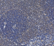 IHC staining of FFPE rat spleen with IRAK2 antibody. HIER: boil tissue sections in pH8 EDTA for 20 min and allow to cool before testing.