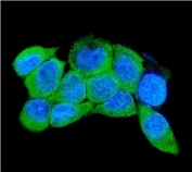 Immunofluorescent staining of FFPE human A431 cells with IRAK2 antibody (green) and DAPI nuclear stain (blue). HIER: steam section in pH6 citrate buffer for 20 min.