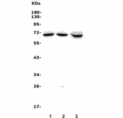 Western blot testing of 1) human A549, 2) human Caco-2 and 3) mouse ANA-1 lysate with IRAK2 antibody. Predicted molecular weight ~69 kDa.