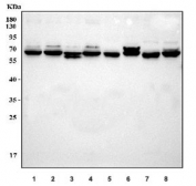 Western blot testing of 1) human K562, 2) human MOLT4, 3) human Jurkat, 4) human Raji, 5) rat thymus, 6) rat PC-12, 7) mouse thymus and 8) mouse RAW264.7 cell lysate with IRAK2 antibody. Predicted molecular weight ~69 kDa.