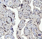 IHC staining of FFPE human placental tissue with Menin antibody. HIER: boil tissue sections in pH8 EDTA for 20 min and allow to cool before testing.