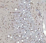IHC staining of FFPE rat brain tissue with Menin antibody. HIER: boil tissue sections in pH8 EDTA for 20 min and allow to cool before testing.