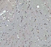 IHC staining of FFPE mouse brain tissue with Menin antibody. HIER: boil tissue sections in pH8 EDTA for 20 min and allow to cool before testing.