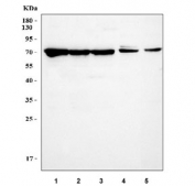 Western blot testing of 1) human HepG-2, 2) human 293T, 3) human HeLa, 4) rat brain and 5) mouse brain tissue lysate with Menin antibody. Predicted molecular weight ~68 kDa.