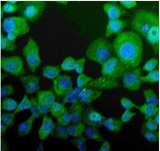 Immunofluorescent staining of FFPE human A431 cells with Niemann Pick C2 antibody (green) and DAPI nuclear stain (blue). HIER: steam section in pH6 citrate buffer for 20 min.