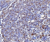 IHC staining of FFPE mouse spleen with Niemann Pick C2 antibody. HIER: boil tissue sections in pH8 EDTA for 20 min and allow to cool before testing.
