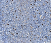 IHC staining of FFPE human tonsil with Niemann Pick C2 antibody. HIER: boil tissue sections in pH8 EDTA for 20 min and allow to cool before testing.