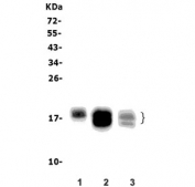 Western blot testing of 1) human PC-3, 2) rat kidney and 3) mouse kidney lysate with Niemann Pick C2 antibody. Predicted molecular weight: ~17 kDa, can be observed as a ~21/23 kDa doublet in some samples.