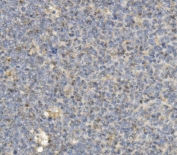IHC staining of FFPE human tonsil with CCR2 antibody. HIER: boil tissue sections in pH8 EDTA for 20 min and allow to cool before testing.