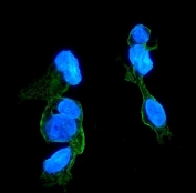 Immunofluorescent staining of FFPE human HepG2 cells with CCR2 antibody (green) and DAPI nuclear stain (blue). HIER: steam section in pH6 citrate buffer for 20 min.