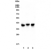 Wester blot testing of human 1) ThP-1, 2) K562 and 3) Jurkat lysate with CCR2 antibody. Predicted molecular weight ~42 kDa.