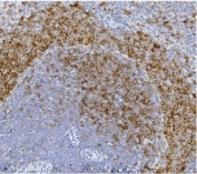 IHC staining of FFPE rat spleen with CD79b antibody. HIER: boil tissue sections in pH8 EDTA for 20 min and allow to cool before testing.