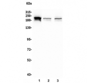 Western blot testing of human 1) HeLa, 2) ThP-1 and 3) U-87 MG lysate with SMARCA2 antibody. Predicted molecular weight ~181 kDa. 