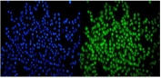 Immunofluorescent staining of FFPE human A549 cells with SMARCA2 antibody (green) and DAPI nuclear stain (blue). HIER: steam section in pH6 citrate buffer for 20 min.