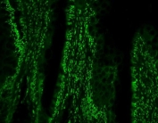 Immunofluorescent staining of FFPE rat intestine with PTBP1 antibody. HIER: steam section in pH6 citrate buffer for 20 min.