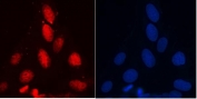 Immunofluorescent staining of FFPE human U-2 OS cells with RENT1 antibody (red) and DAPI nuclear stain (blue). HIER: steam section in pH6 citrate buffer for 20 min.