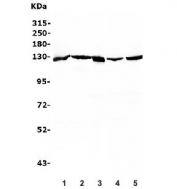 Western blot testing of human 1) HepG2, 2) Raji, 3) PC-3, 4) HeLa and 5) HEK293 lysate with RENT1 antibody. Predicted molecular weight ~124 kDa, but routinely observed at 130-140 kDa.