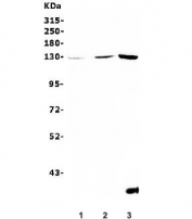 Western blot testing of 1) rat brain, 2) mouse brain and 3) mouse RAW264.7 lysate with RENT1 antibody. Predicted molecular weight ~124 kDa, but routinely observed at 130-140 kDa.