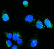 Immunofluorescent staining of FFPE human HeLa cells with HK1 antibody (green) and DAPI nuclear stain (blue). HIER: steam section in pH6 citrate buffer for 20 min.