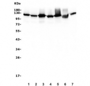 Western blot testing of human 1) HeLa, 2) HEK293, 3) U-87 MG, 4) K562, 5) A549, 6) rat PC-12 and 7) mouse NIH 3T3 lysate with HK1 antibody. Predicted molecular weight ~120 kDa.