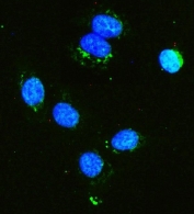 Immunofluorescent staining of FFPE human U-2 OS cells with HK1 antibody (green) and DAPI nuclear stain (blue). HIER: steam section in pH6 citrate buffer for 20 min.