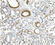 IHC staining of FFPE human placenta with MCAM antibody. HIER: boil tissue sections in pH8 EDTA for 20 min and allow to cool before testing.