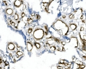 IHC staining of frozen human placenta with MCAM antibody.