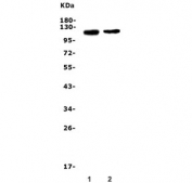 Western blot testing of human 1) A375 and 2) HeLa lysate with MCAM antibody. Observed molecular weight 70-120 kDa depending on glycosylation level.