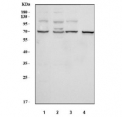 Western blot testing of 1) human HeLa, 2) human 293T, 3) human A549 and 4) rat kidney tissue lysate with Folliculin antibody. Expected molecular weight: 64-70 kDa.