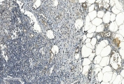 IHC staining of FFPE human appendicitis tissue with Folliculin antibody. HIER: boil tissue sections in pH8 EDTA for 20 min and allow to cool before testing.
