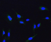 Immunofluorescent staining of FFPE human HeLa cells with ME2 antibody (green) and DAPI nuclear stain (blue). HIER: steam section in pH6 citrate buffer for 20 min.