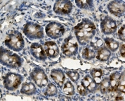 IHC staining of FFPE rat intestine with ME2 antibody. HIER: boil tissue sections in pH8 EDTA for 20 min and allow to cool before testing.