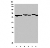 Western blot testing of human 1) Jurkat, 2) K562, 3) HEK293, 4) placenta, 5) PC-3 and 6) mouse COS-7 lysate with ME2 antibody. Predicted molecular weight ~65 kDa.