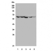 Western blot testing of rat 1) spleen, 2) thymus, 3) kidney and mouse 4) RAW264.7 and 5) NIH 3T3 lysate with ME2 antibody. Predicted molecular weight ~65 kDa.