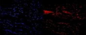 Immunofluorescent staining of FFPE mouse skeletal muscle with NFIC antibody (red) and DAPI nuclear stain (blue). HIER: steam section in pH6 citrate buffer for 20 min.