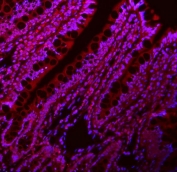 Immunofluorescent staining of FFPE rat intestine with LIN28A antibody (red) and DAPI nuclear stain (blue). HIER: steam section in pH6 citrate buffer for 20 min.