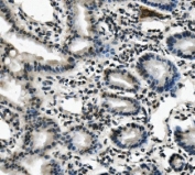 IHC staining of FFPE mouse intestine with LIN28A antibody. HIER: boil tissue sections in pH8 EDTA for 20 min and allow to cool before testing.