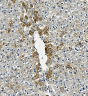 IHC staining of FFPE rat liver with Hepatic Lipase antibody. HIER: boil tissue sections in pH8 EDTA for 20 min and allow to cool before testing.