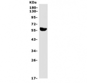 Western blot testing of rat liver lysate with Hepatic Lipase antibody. Predicted molecular weight ~56 kDa.