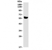 Western blot testing of rat liver lysate with Hepatic Lipase antibody. Predicted molecular weight ~56 kDa.