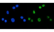 Immunofluorescent staining of FFPE human A549 cells with Muscleblind-like 1 antibody (green) and DAPI nuclear stain (blue). HIER: steam section in pH6 citrate buffer for 20 min.