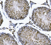 IHC staining of FFPE rat testis tissue with Muscleblind-like 1 antibody. HIER: boil tissue sections in pH8 EDTA for 20 min and allow to cool before testing.