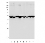 Western blot testing of human 1) HeLa, 2) HepG2, 3) SH-SY5Y, 4) U-87 MG, 5) HEK293, 6) Caco-2, 7) monkey kidney and 8) monkey liver lysate with Enolase 1 antibody. Predicted molecular weight ~47 kDa.